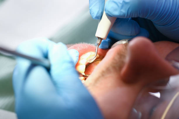 Best Broken Tooth Emergency  in Benton Park, CA