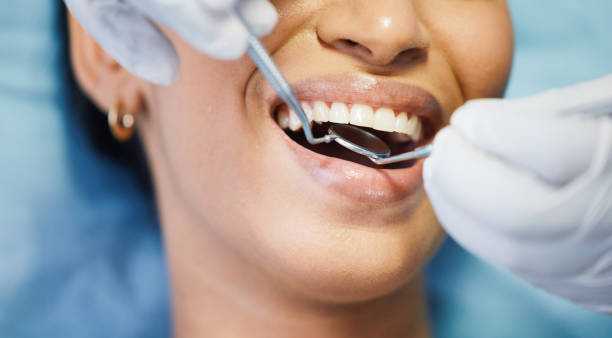 Best Emergency Gum Pain Relief  in Benton Park, CA